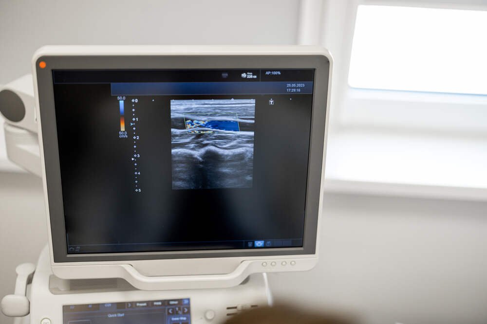 Ultrasound machine screen with examination onscreen. Medazur Medical Clinic in Leytonstone.
